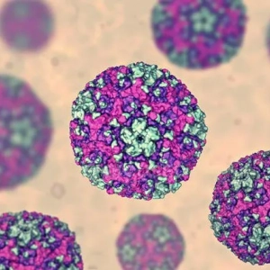 Wirusowe zapalenie opon mózgowych: leczenie, objawy, przyczyny i diagnoza